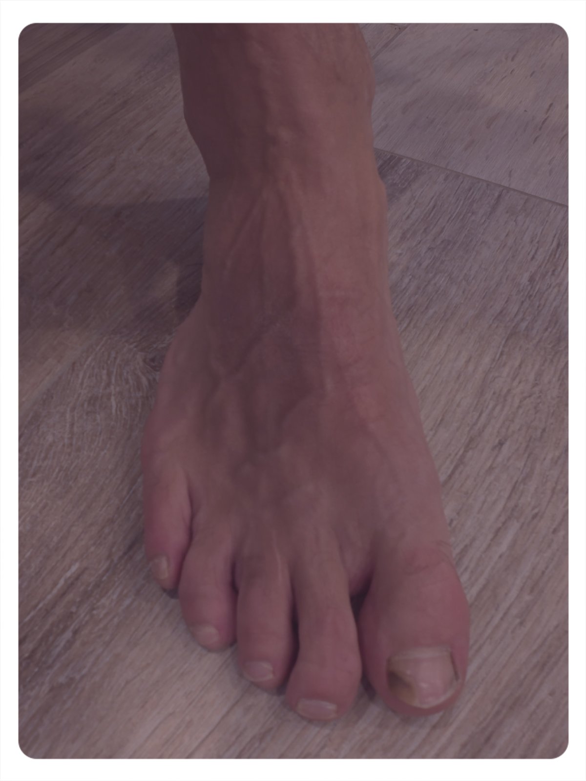 podologie-pathologie-des-ongles---catherine-briel Pathologie ongles